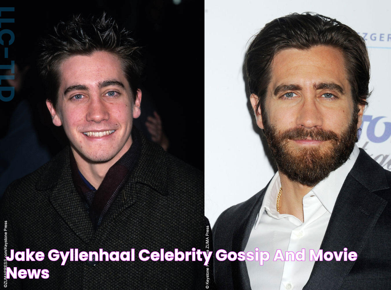 Jake Gyllenhaal's Nose Job: Before And After