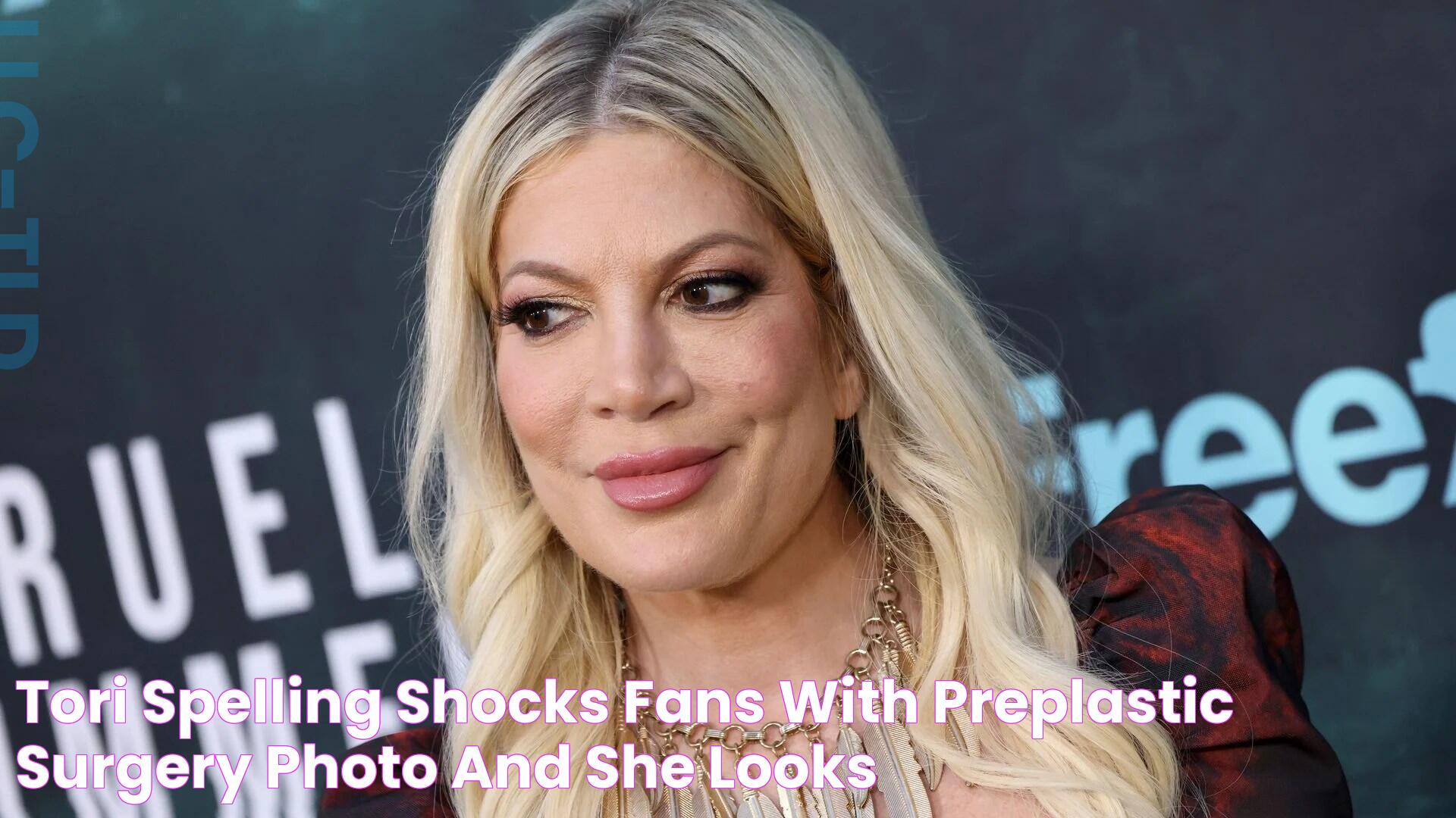 Tori Spelling shocks fans with preplastic surgery photo and she looks