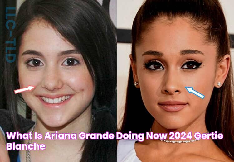 Eye-Opening Truth: Does Ariana Grande Really Have A Crossed Eye?