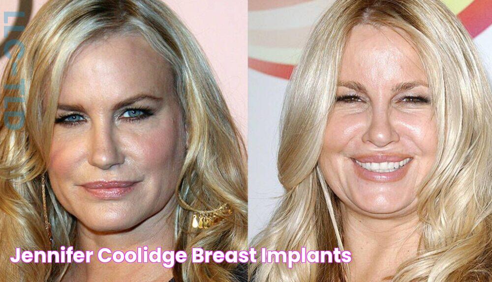 Unrecognizable: Jennifer Coolidge Before Plastic Surgery