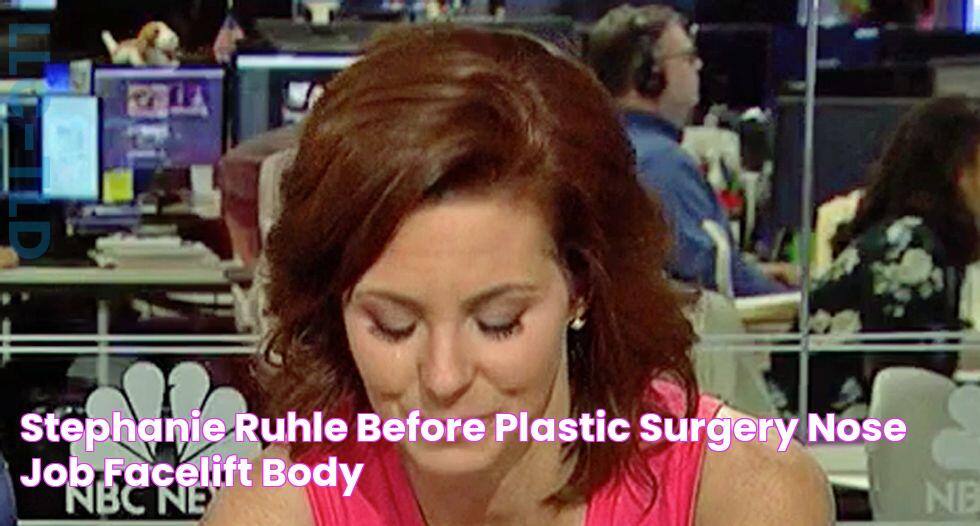 Stephanie Ruhle Before Plastic Surgery Nose Job, Facelift, Body