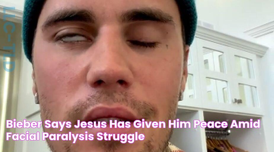 Bieber says Jesus has given him peace amid facial paralysis struggle