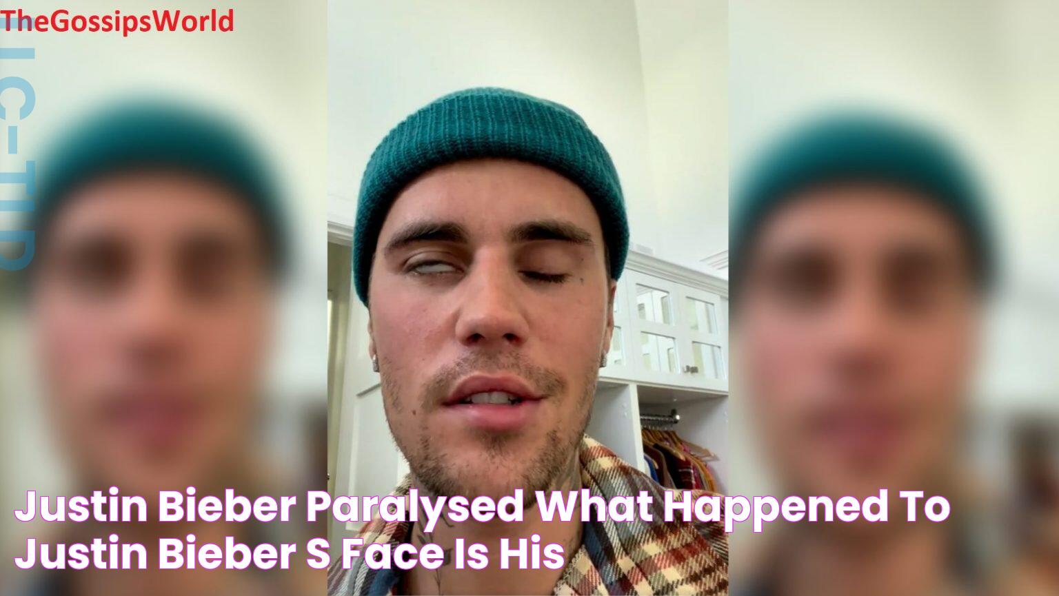 Justin Bieber Paralysed What Happened To JUSTIN BIEBER's FACE? Is His